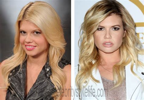 chanel west coast before surgery|Chanel West Coast Got Liposuction Instead of Taking Ozempic。